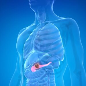 New AI model spots pancreatic cancer up to 3 years earlier than human doctors in test