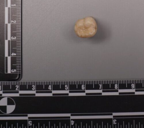 Protein in Homo erectus teeth suggests Denisovans gave us some of their DNA