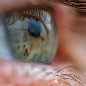 A new test could flag people at risk for anemia by filming their eyeballs — no needles required