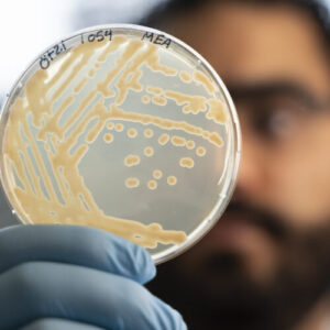 Some ancient microbes frozen with Ötzi the Iceman are still growing