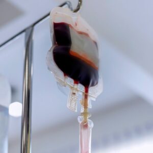 Diagnostic dilemma: 6-year-old develops life-threatening allergic reaction after blood transfusion