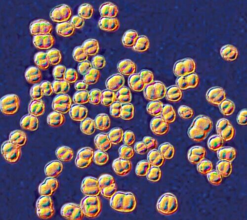 College lab class ends with 32 people on antibiotics for deadly germ exposure