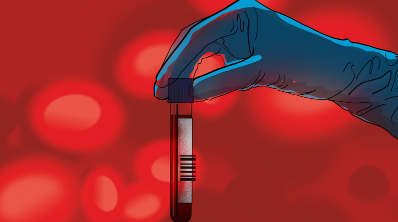 Alzheimer’s blood tests are transforming how patients get diagnosed — here’s what to know