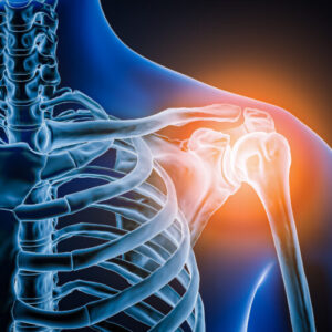 Doctors took a look at man’s painful shoulder—they found the joint was missing