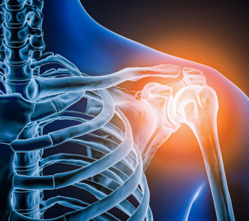 Doctors took a look at man’s painful shoulder—they found the joint was missing