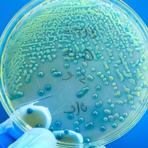 ‘It’s real, and it’s happening’: Antibiotic resistance in kids is rising around the world, massive study finds