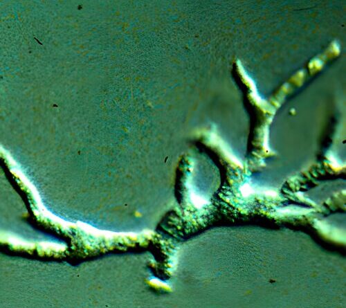 Toddler’s tragic death from brain-destroying amoeba offers lessons for doctors