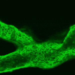 Mini ‘arteries-on-a-chip’ could help predict a person’s risk of stroke