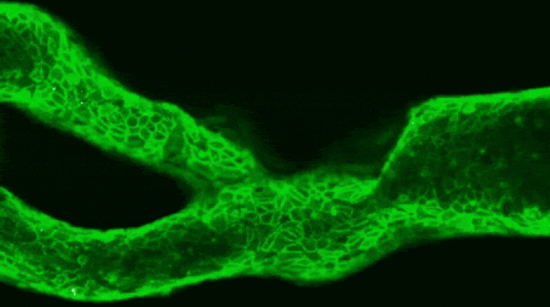 Mini ‘arteries-on-a-chip’ could help predict a person’s risk of stroke