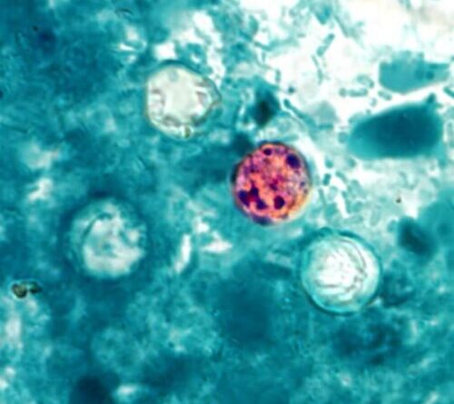 Trump admin shelves Cyclospora research despite record-breaking outbreak