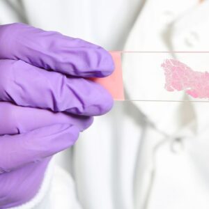 AI trained to ‘think’ like human pathologists may be better at spotting cancer