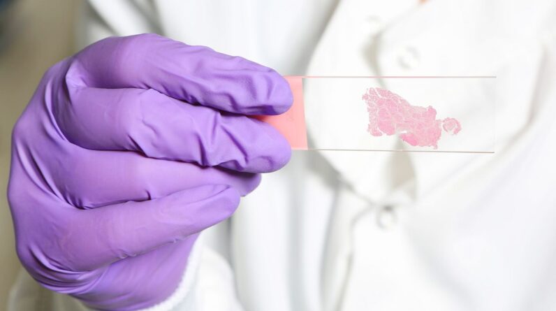 AI trained to ‘think’ like human pathologists may be better at spotting cancer