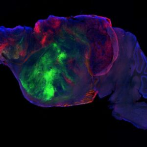Scientists shrank mice’s brains and replaced the missing tissue with human ‘organoids’