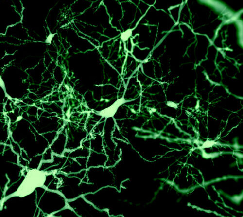 Finding the cells that put our brain to sleep