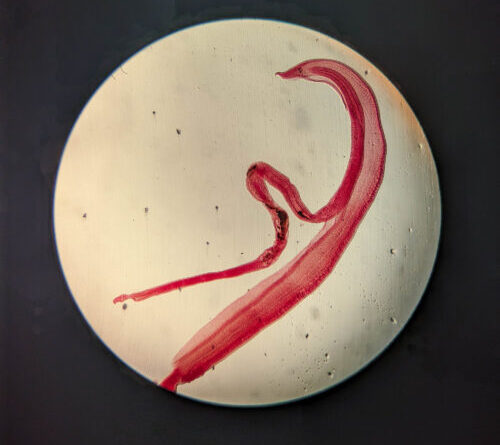Woman’s brain worm infection confirmed after eggs grow tails in lab test