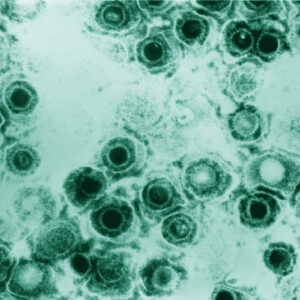 Cold Sore Virus Leaves Mark on Brain’s Immune Cells, Animal Study Shows